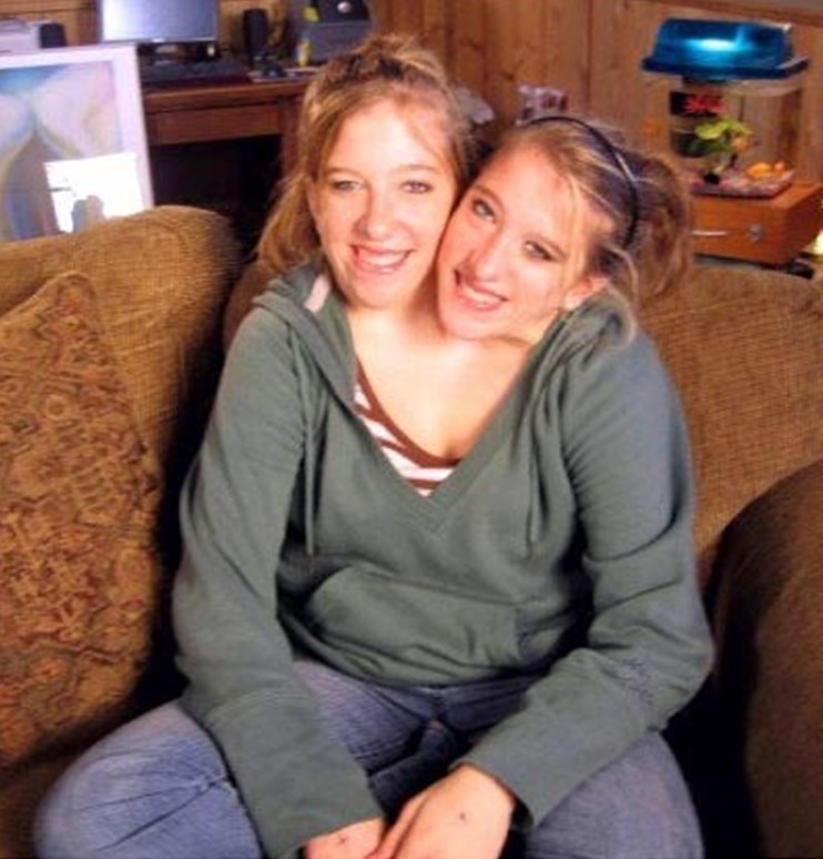 30 Fun Things About Conjoined Twins Abby and Brittany 