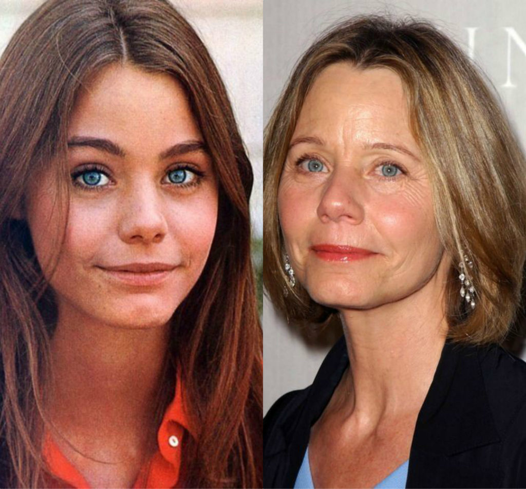 Susan Dey1