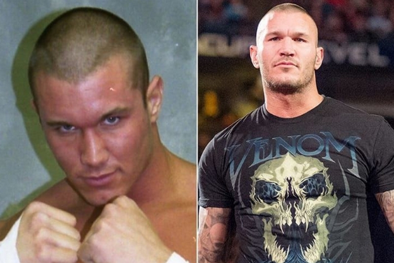 Randy Orton