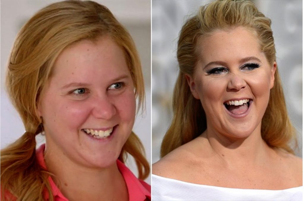 Amy Schumer