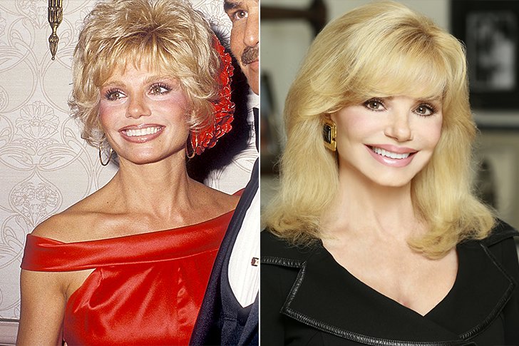 Loni Anderson