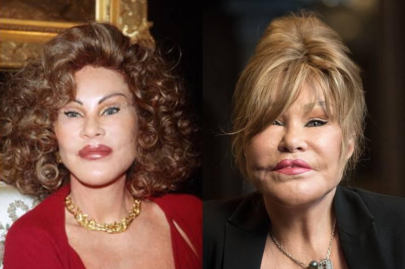 Jocelyn Wildenstein (Rumored) $6.7 Million