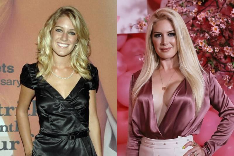 Heidi Montag (Admitted) $1 Million+