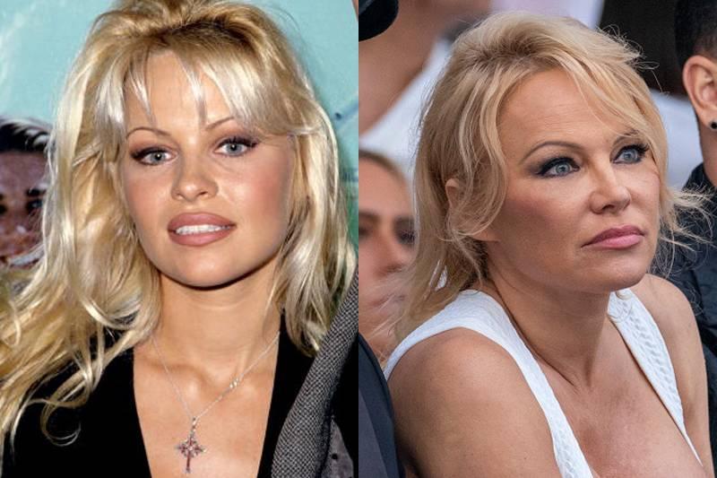 Pamela Anderson (Estimated) $10,500