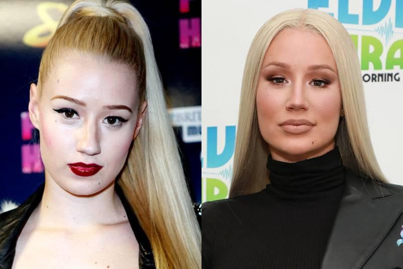 Iggy Azalea (Estimated) $20,000